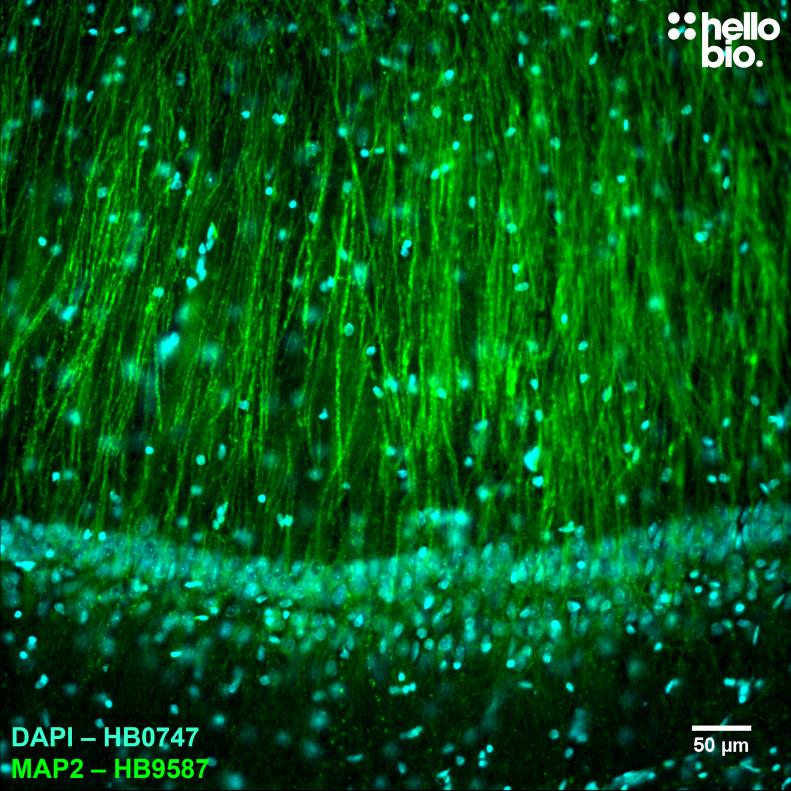 Figure 4. MAP2 expression in rat CA1 pyramidal neurones visualised using HB9587.