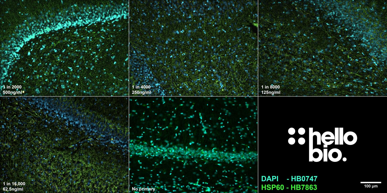 Figure 5. The effect of varying HB7863 concentration upon staining in rat dentate gyrus.