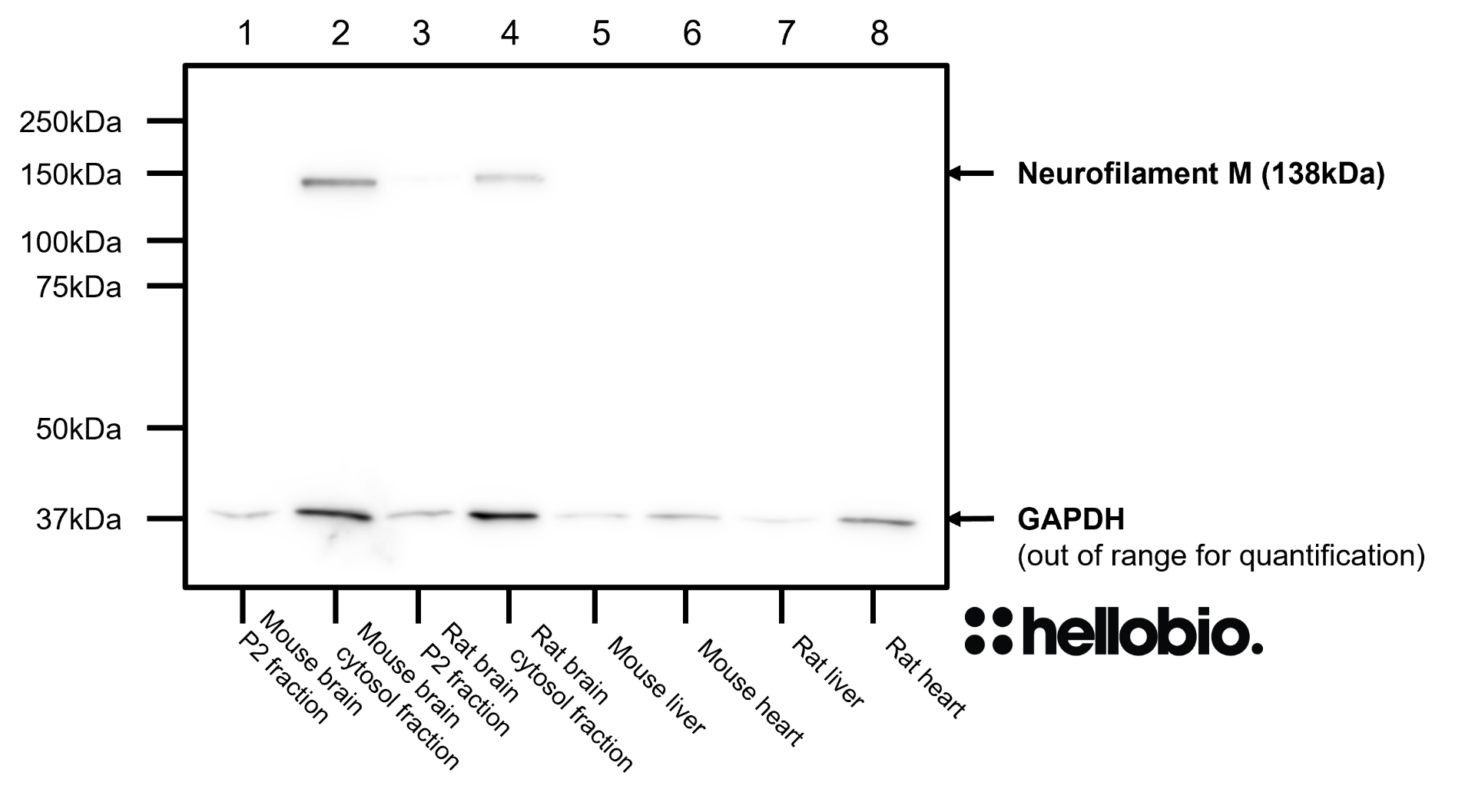 Figure 7. Neurofilament M and GAPDH expression in various tissue lysates and preparations. 