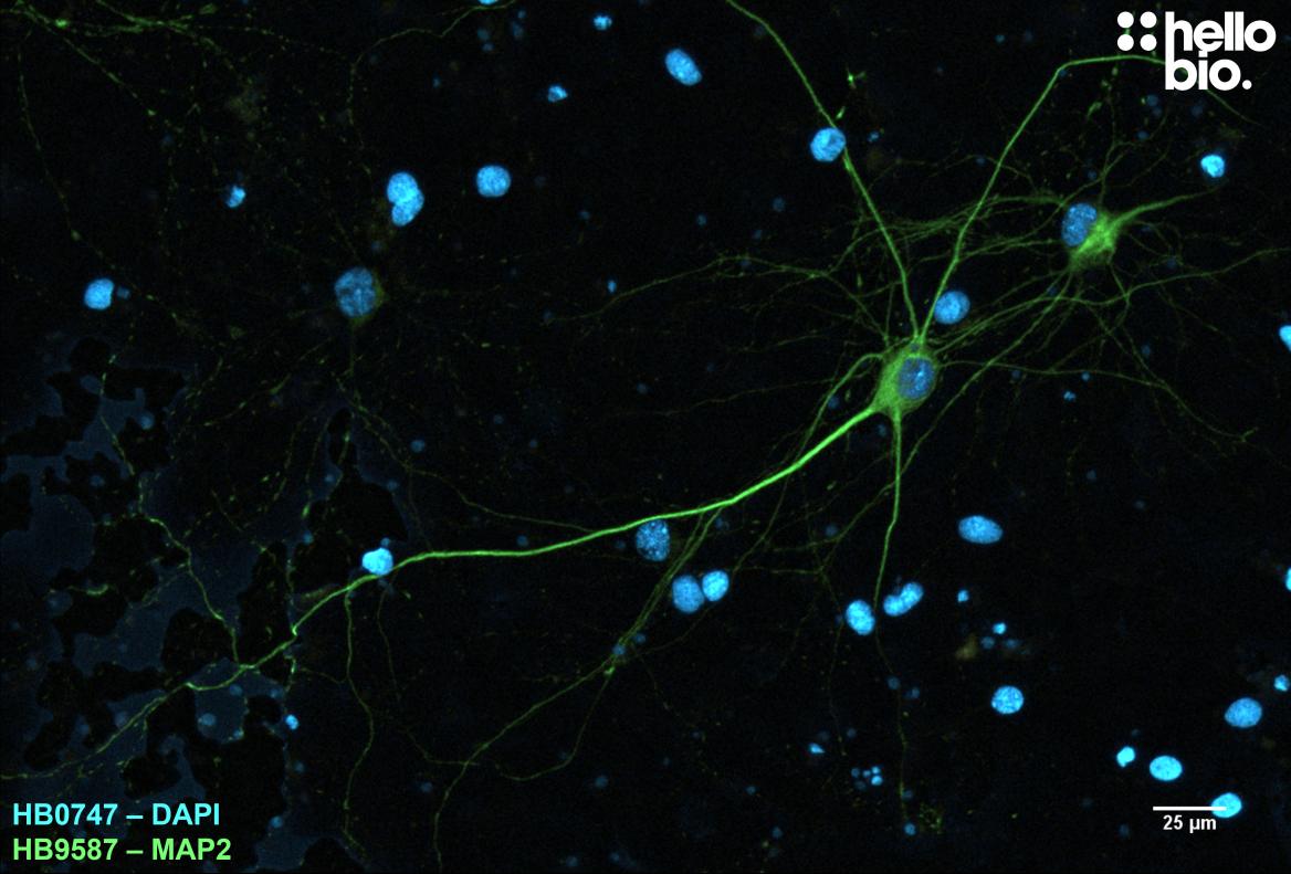 Figure 6. MAP2 expression in cultured rat neurones visualised using HB9587.