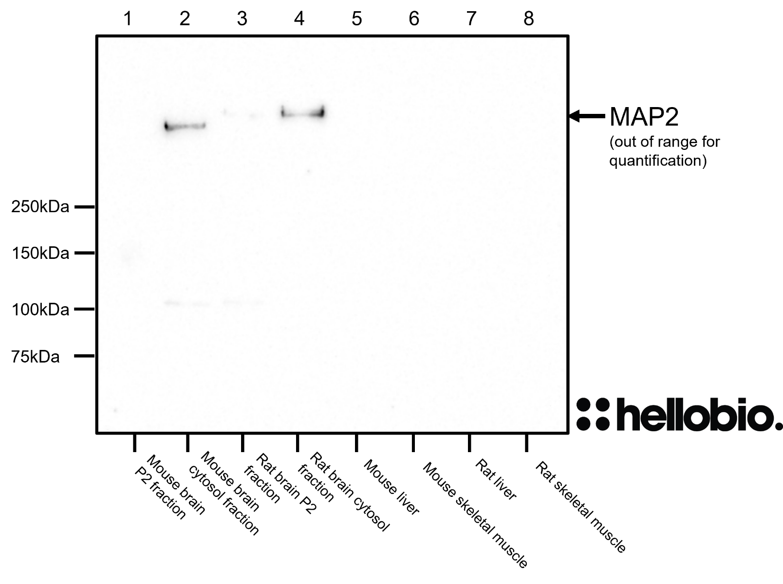 Figure 8. MAP2 expression in various tissue lysates and preparations. 