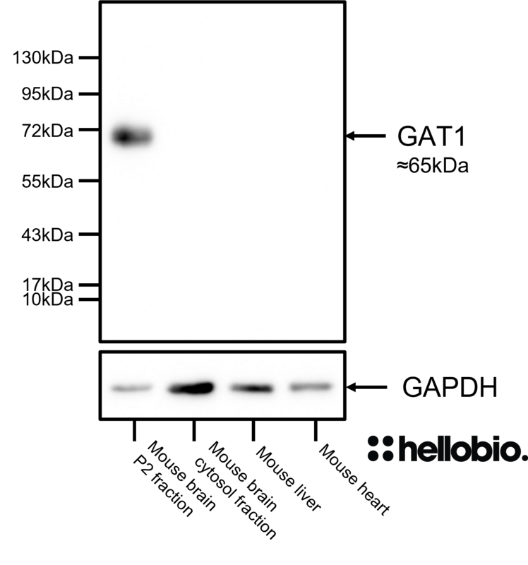 Figure 5. GAT1 expression in mouse brain P2 membrane fraction but not other mouse tissue lysates and preparations. 