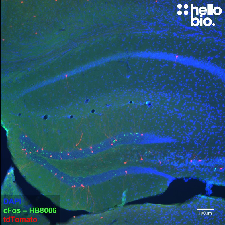 Figure 1. c-Fos expression in the dentate gyrus of TRAP2;Ai14 mice. 