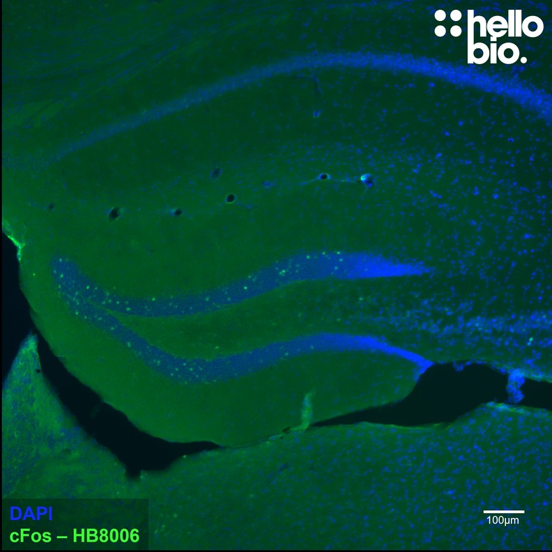 Figure 3. c-Fos expression in mouse dentate gyrus. 