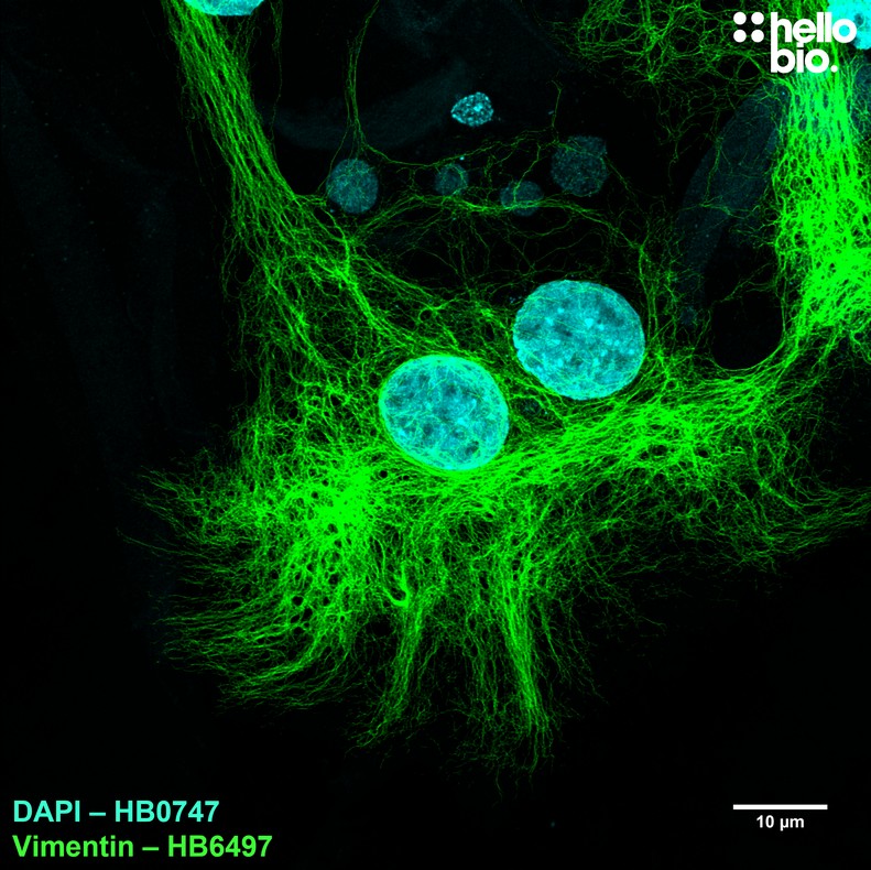 Figure 3. Vimentin expression in glia within a cultured rat neuron preparation.