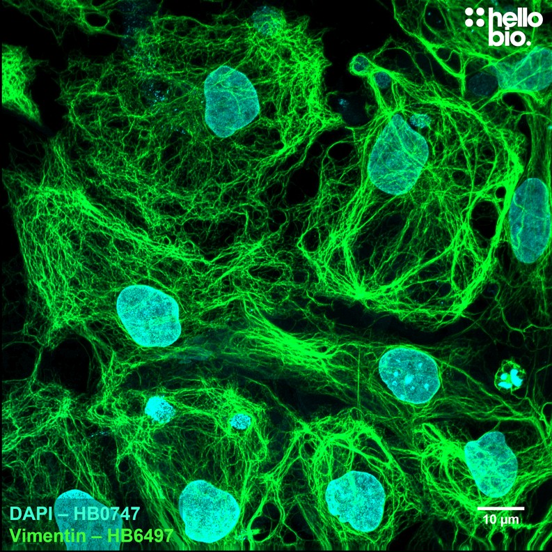 Figure 1. Vimentin expression in glia within a cultured rat neuron preparation.