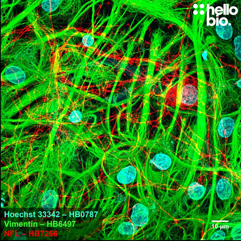 Figure 6. Vimentin labelled glia and Neurofilament light labelled neurons in a cultured rat neuron preparation.