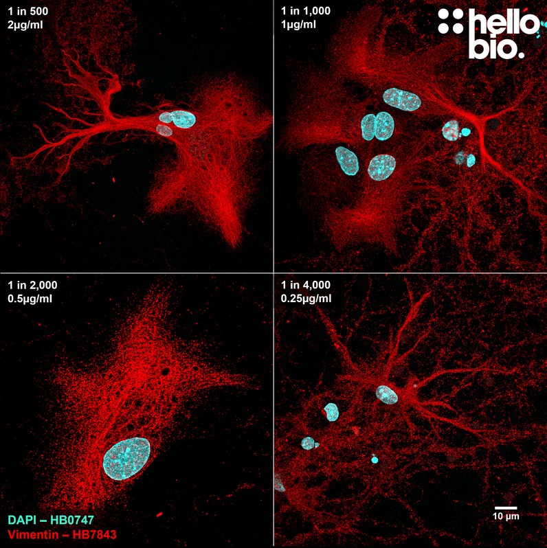 Figure 5. Concentration response of HB7843 in mixed neuronal cultures.