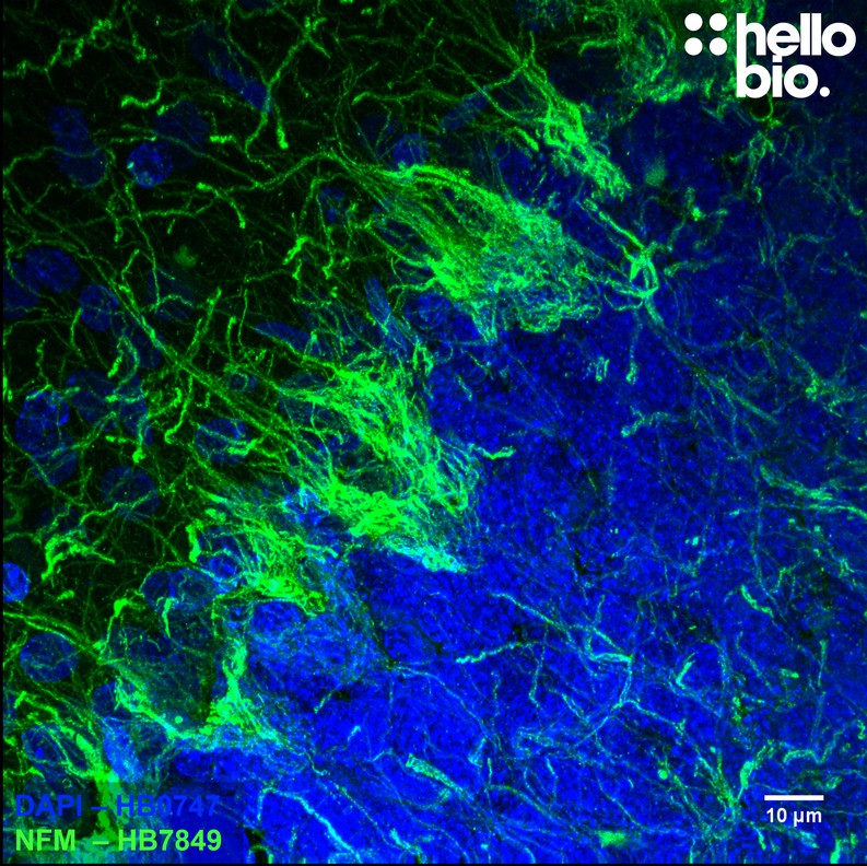 Figure 5. Neurofilament M expression in rat cerebellum