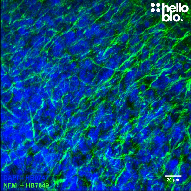 Figure 6. Dense network of axonal projections visualised using HB7849 in rat cerebellum.