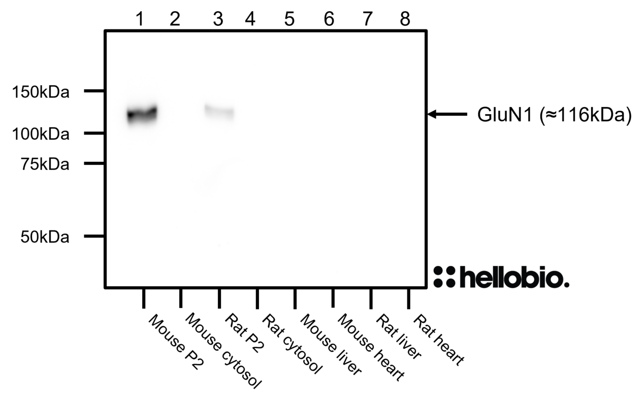 Figure 7. GluN1 expression only observed within brain P2 membrane fractions when probed with HB7535.