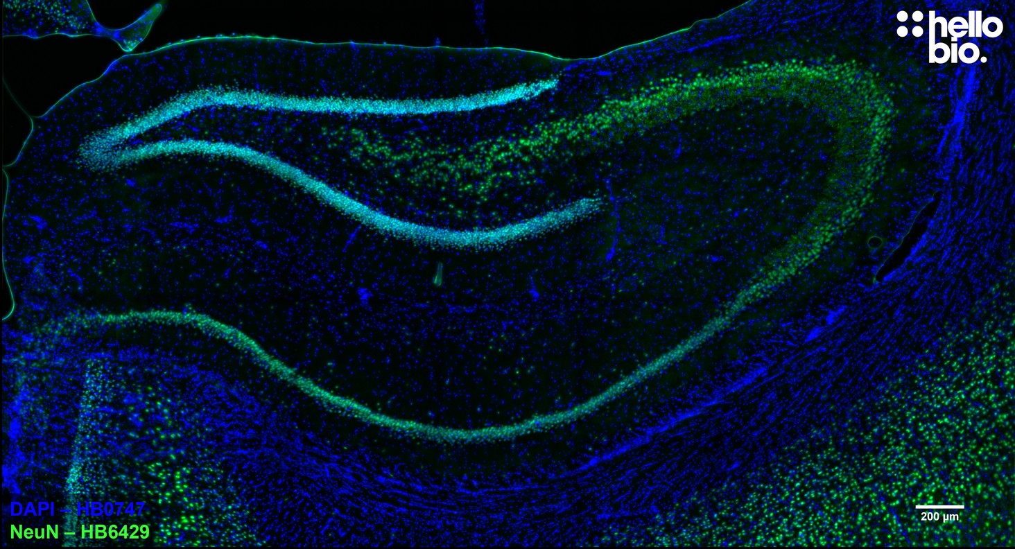 Figure 1. HB6429 staining of NeuN expressing neurons in rat hippocampus. 