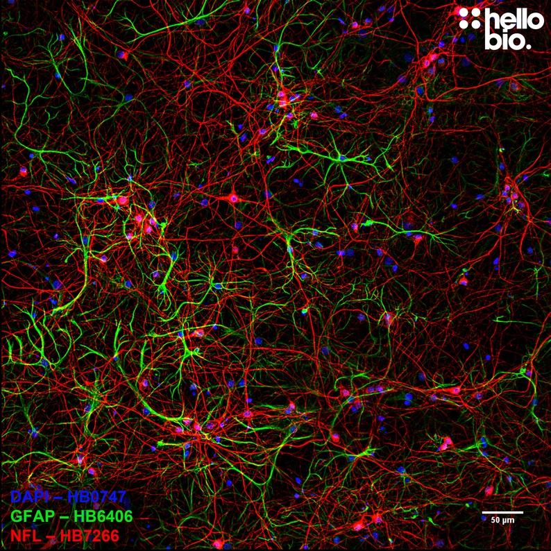 Figure 10. Populations of astrocytes and neurones in a cultured rat neuron preparation.