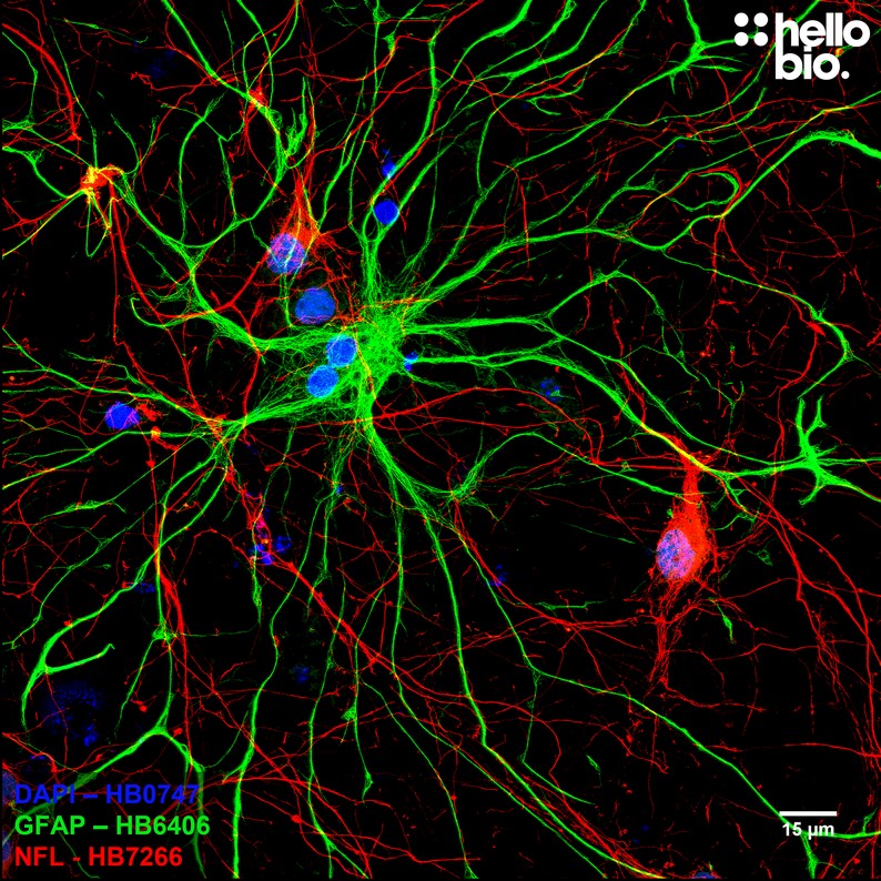 Figure 1. An astrocyte surrounded by neurons in a cultured rat neuron preparation.