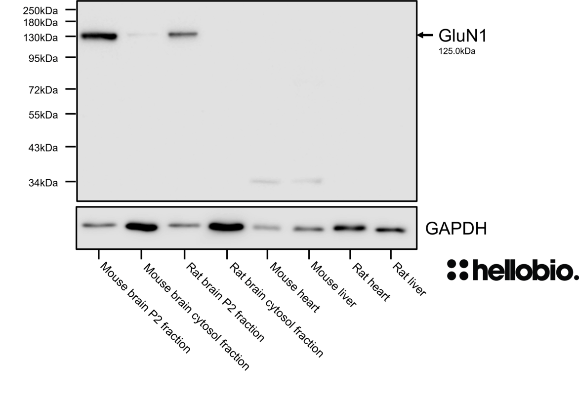 Figure 4. GluN1 expression in brain P2 membrane fractions when probed with HB7535.