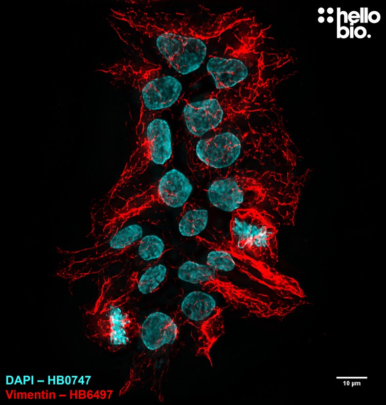 Figure 4. Vimentin staining in HEK293T cells using HB8144 Goat Anti-Mouse IgG H&L (Janelia Fluor® 525) preadsorbed secondary antibody.