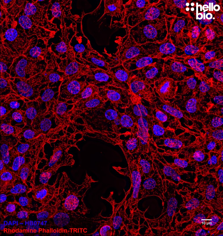 Figure 2. Fixed HEK293T cells mounted using MightyMount<sup>TM</sup> Antifade Fluorescence Mounting Medium with Phalloidin-TRITC (hardset).