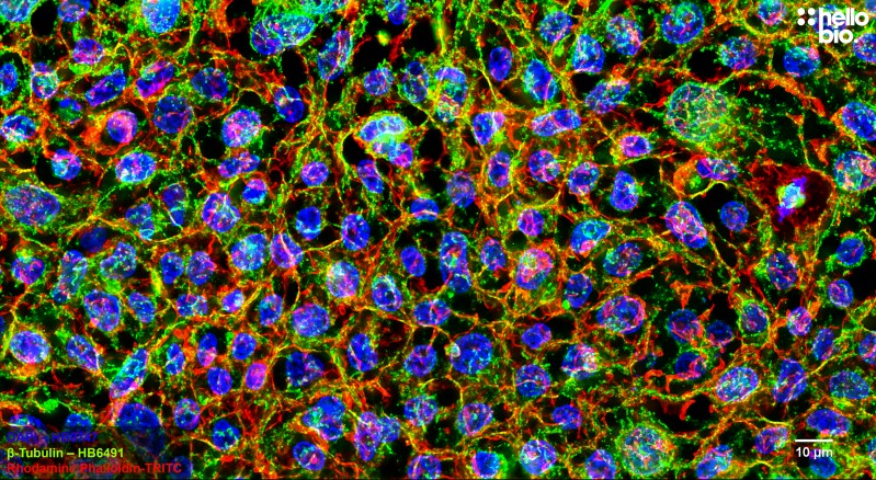 Figure 5. β-tubulin staining in HEK293T cells. Mounted using MightyMount<sup>TM</sup> Antifade Fluorescence Mounting Medium with Phalloidin-TRITC (hardset).