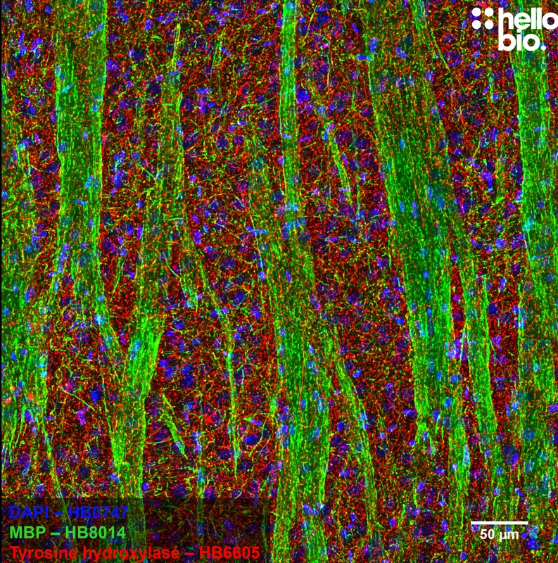 Figure 3. Myelin Basic Protein and Tyrosine hydroxylase expression in rat striatum.