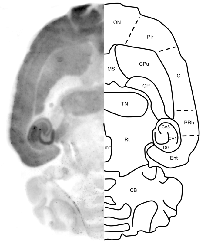 Figure 9. GluN1 histoblot in a horizontal rat brain section using HB7535.