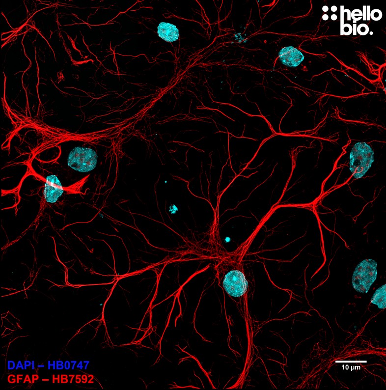 Figure 1. Astrocytes in culture in a cultured rat neuron preparation.