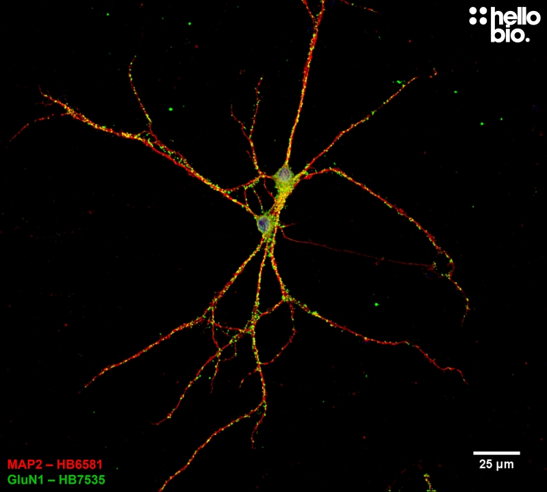 Figure 2. GluN1 expression on a cultured cortical rat neuron using HB6581 MAP2 counterstaining.