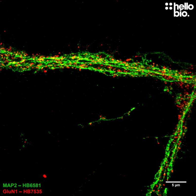 Figure 8. GluN1 receptors on the dendrite of a cultured rat cortical neuron visualized using HB7535.