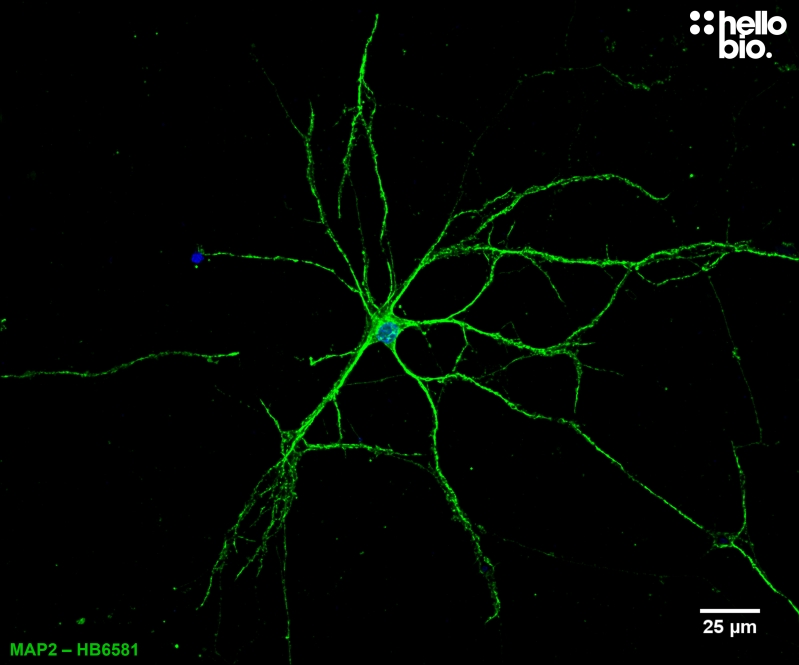 Figure 7. Cultured rat neuron labelled for MAP2 with HB6581