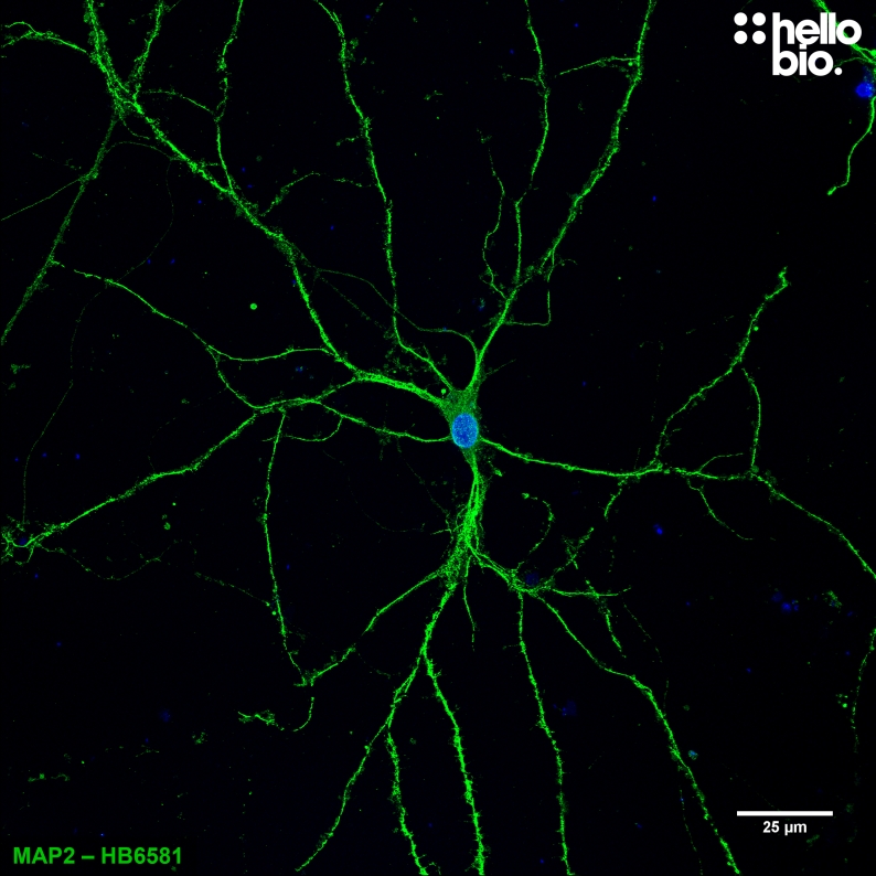 Figure 1. Cultured rat neuron labelled for MAP2 with HB6581