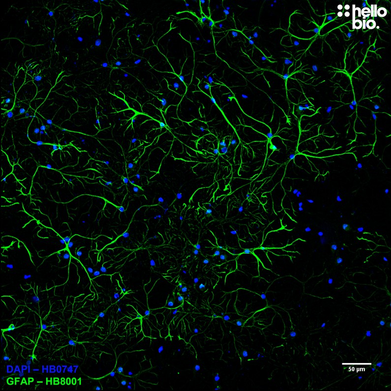 Figure 3. Astrocyte populations in culture stained by HB8001.