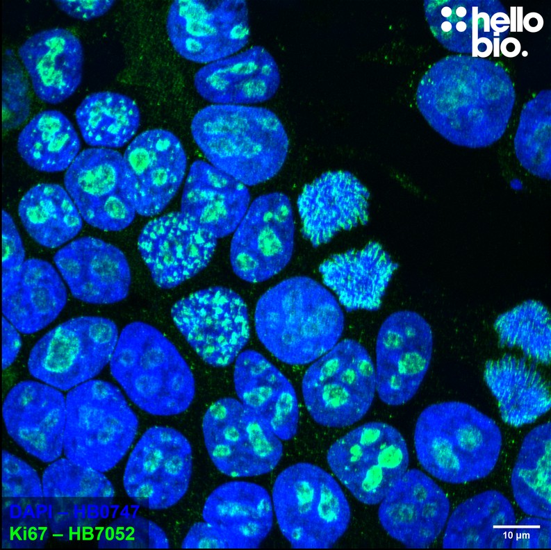 Figure 1. Ki-67 expression in proliferating HEK293T cells