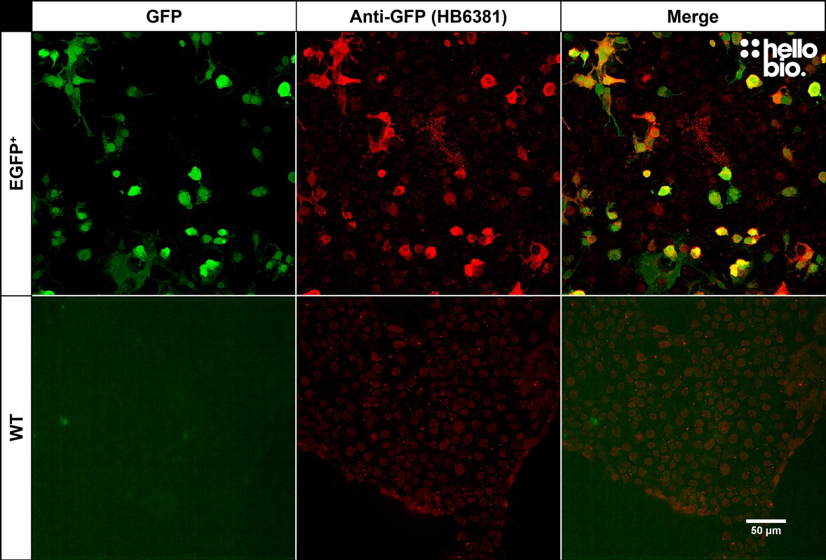 Figure 3. pEGFP-C2 transfected HEK293T cells showing co-localised staining of EGFP and HB6381.