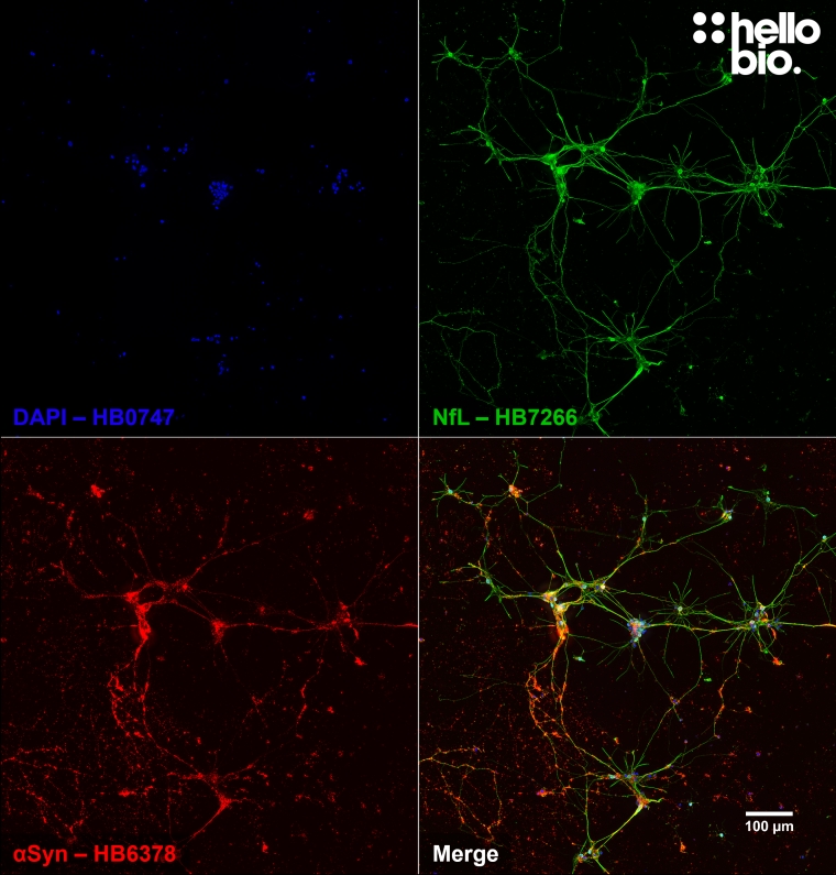 Figure 9. α-Synuclein staining in cultured rat cortical neurons.