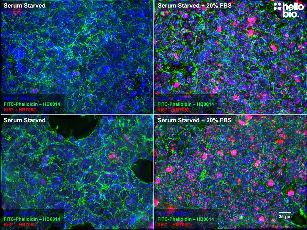 Figure 2. Ki-67 expression is inhibited in serum starved cells but rescued with 20% FBS incubation.