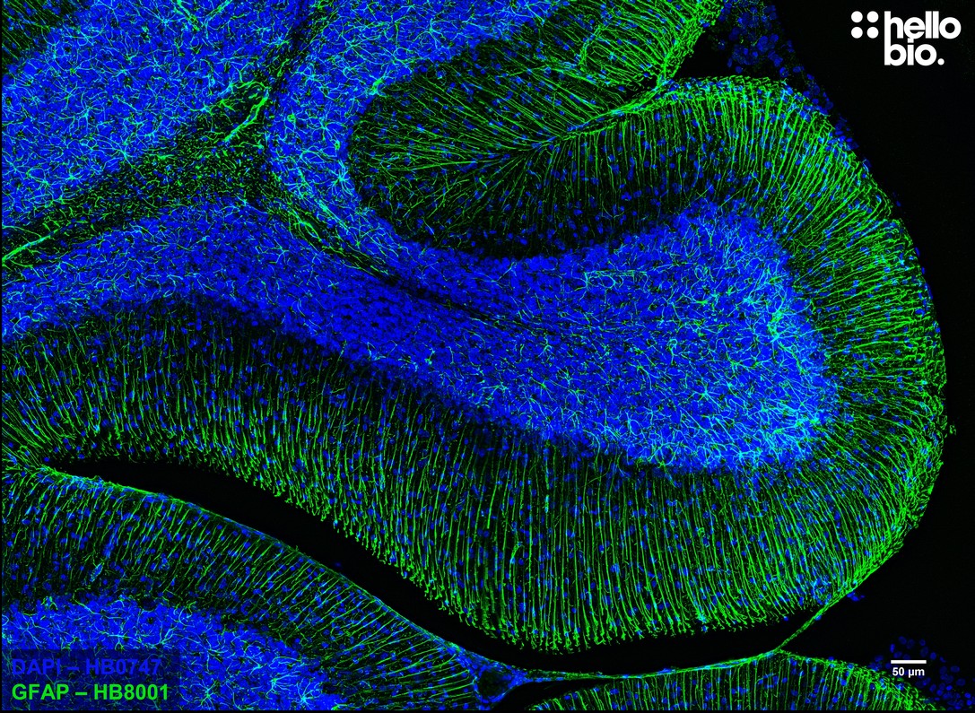 Figure 1. Astrocytes stained for GFAP with HB8001 in the cerebellum.