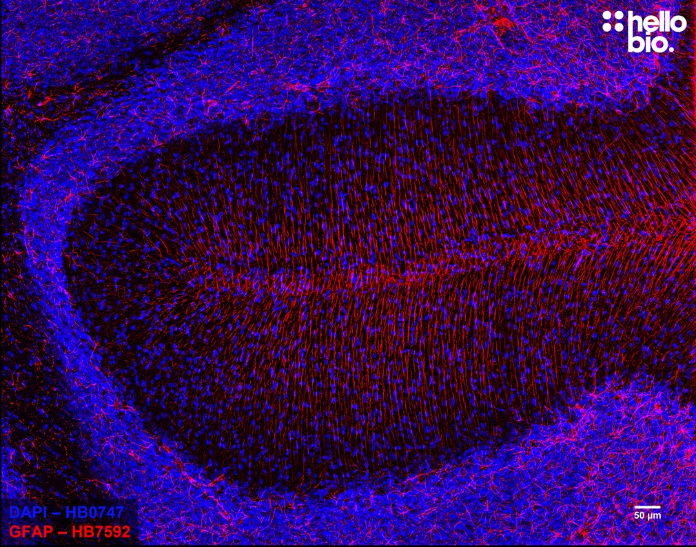 Figure 3. Astrocytes stained for GFAP with HB7592 in the cerebellum