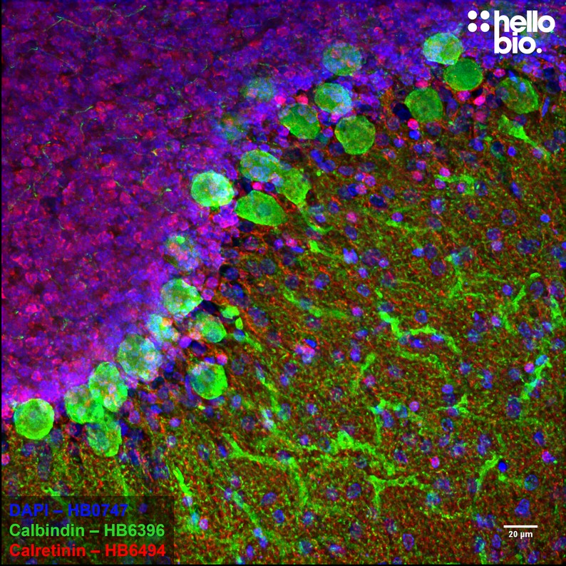 Figure 1. Calbindin and Calretinin expression in rat cerebellum