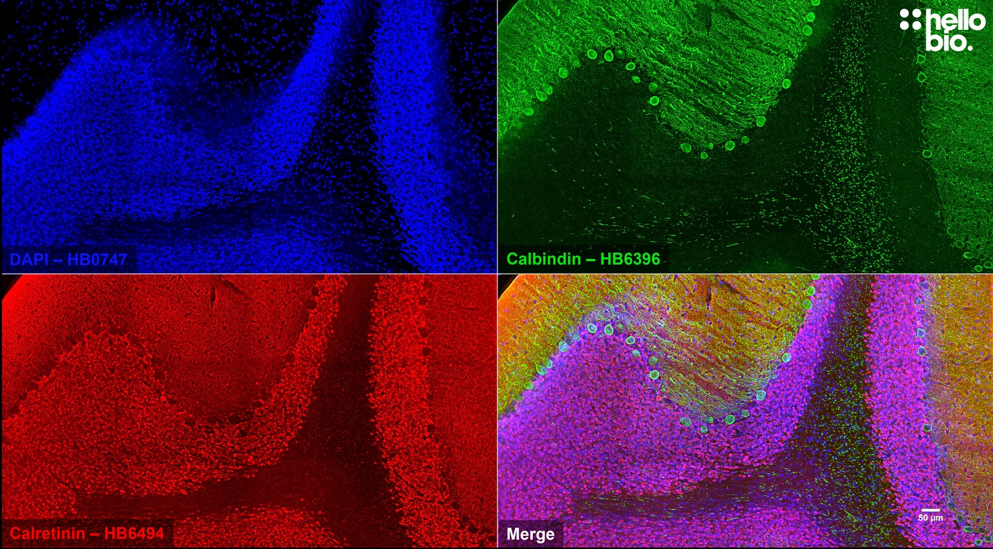 Figure 6. Calbindin and Calretinin positive neurons in rat cerebellum