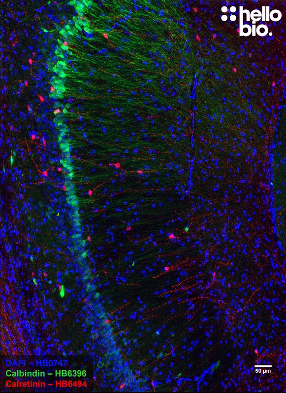 Figure 2. Calbindin and Calretinin expression in rat hippocampus CA1