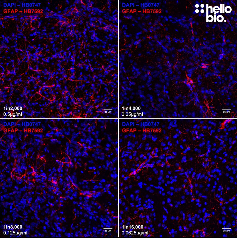 Figure 5. Concentration response of HB7592 staining in cultured rat neurons.