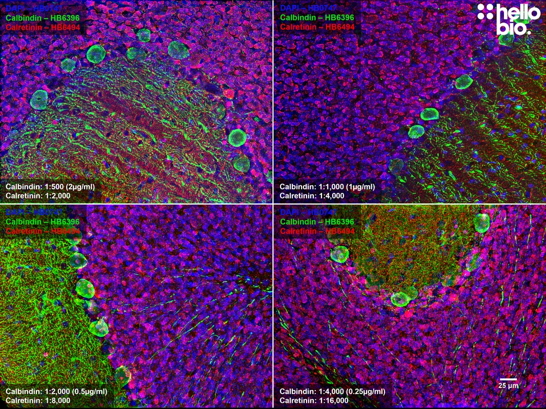 Figure 3. Concentration response of HB6396 and HB6494 in rat cerebellum.