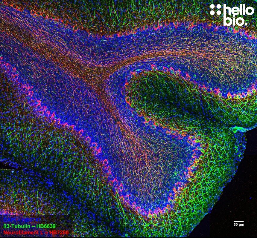 Figure 6. β3-tubulin and Neurofilament L expression in rat cerebellum