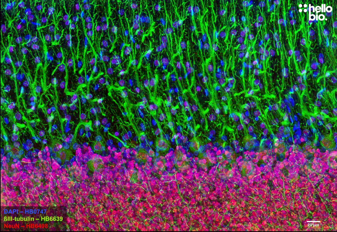 Figure 1. β3-tubulin expression in the Purkinje cells of the cerebellum labelled by HB6639.