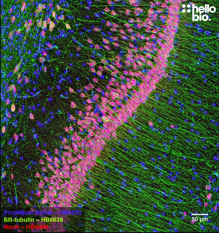 Figure 4. β3-tubulin expression in the pyramidal cell layer of the hippocampus labelled by HB6639.