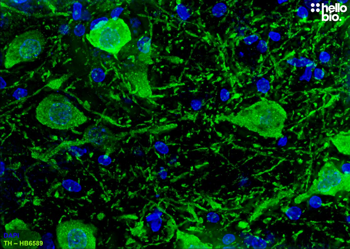 Figure 1. Tyrosine hydroxylase expressing midbrain dopaminergic neurons.