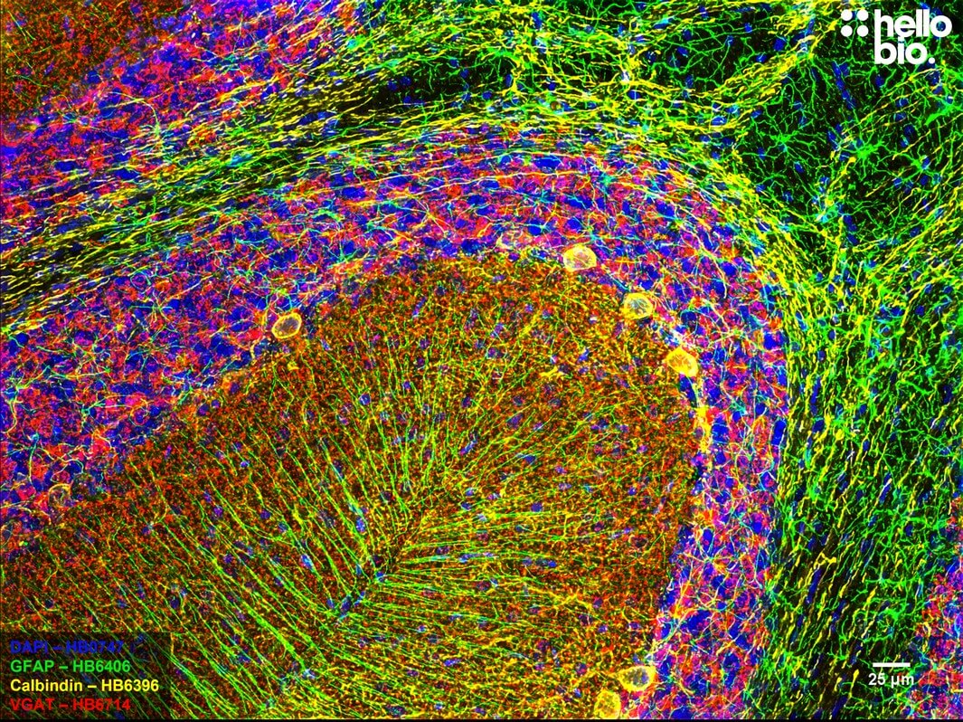 Figure 1. VGAT, Calbindin and GFAP expression in rat cerebellum.