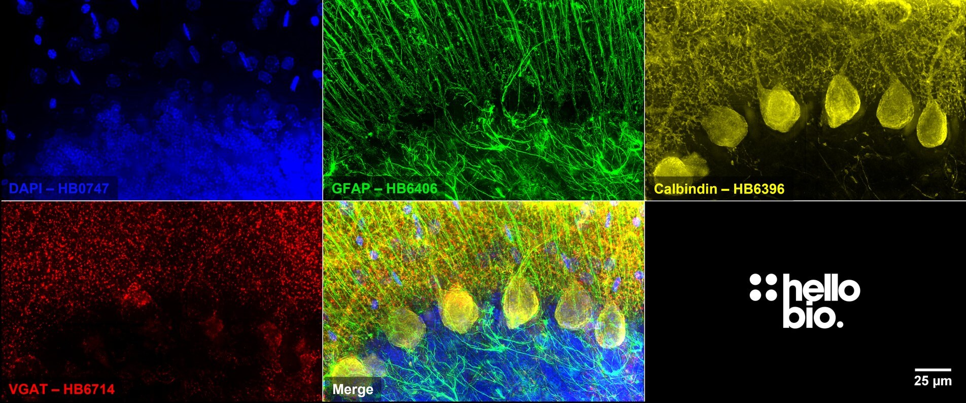 Figure 6. VGAT, Calbindin and GFAP expression in rat cerebellum.