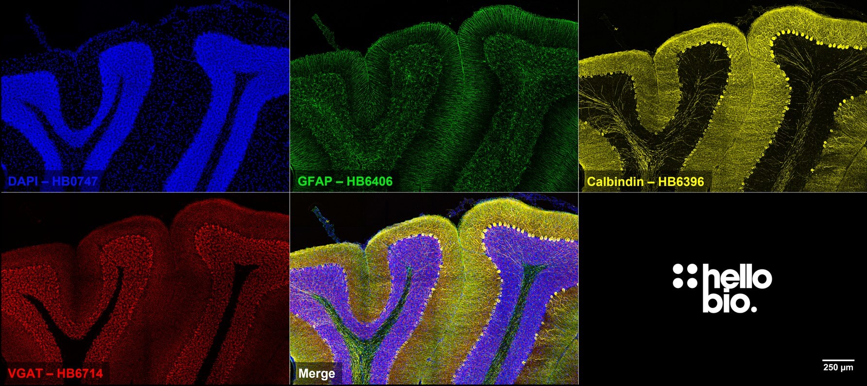 Figure 4. VGAT, Calbindin and GFAP expression in rat cerebellum.