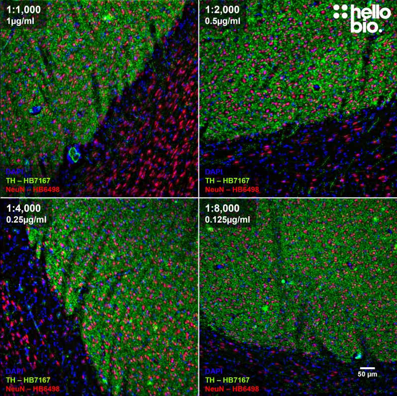 Figure 6. Concentration response of HB7167 staining in rat striatum.