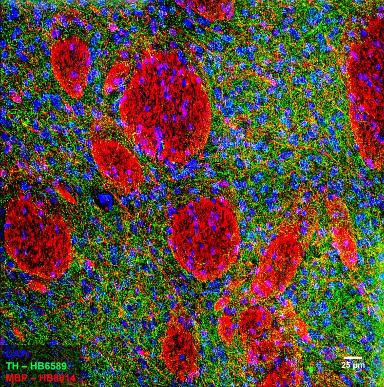 Figure 5. MBP and Tyrosine hydroxylase staining in rat striatum